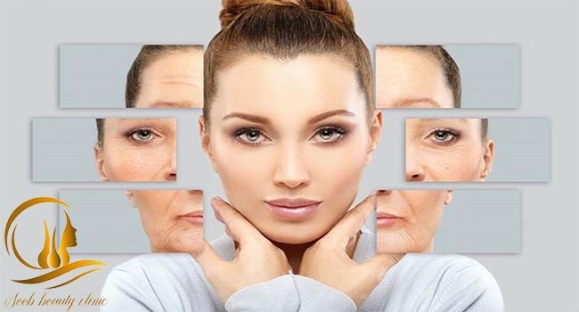 تزریق بوتاکس