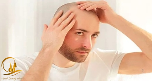بهترین فصل برای کاشت مو چه زمانی است
